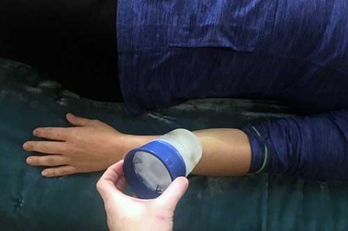 Cryotherapy Quick Fix